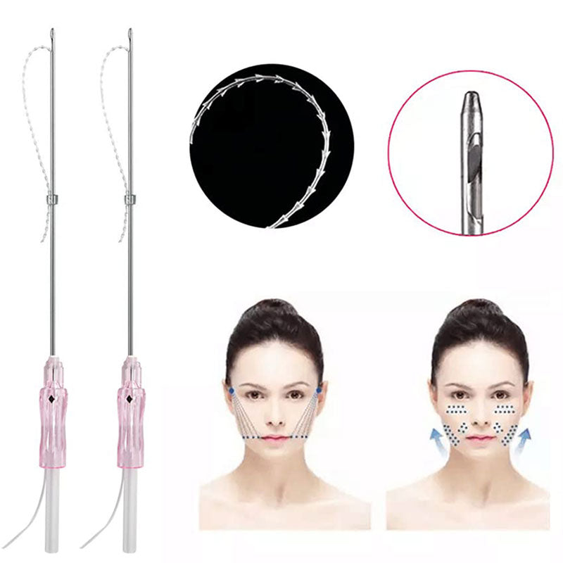 face lift w-blunt cannula pcl threads
