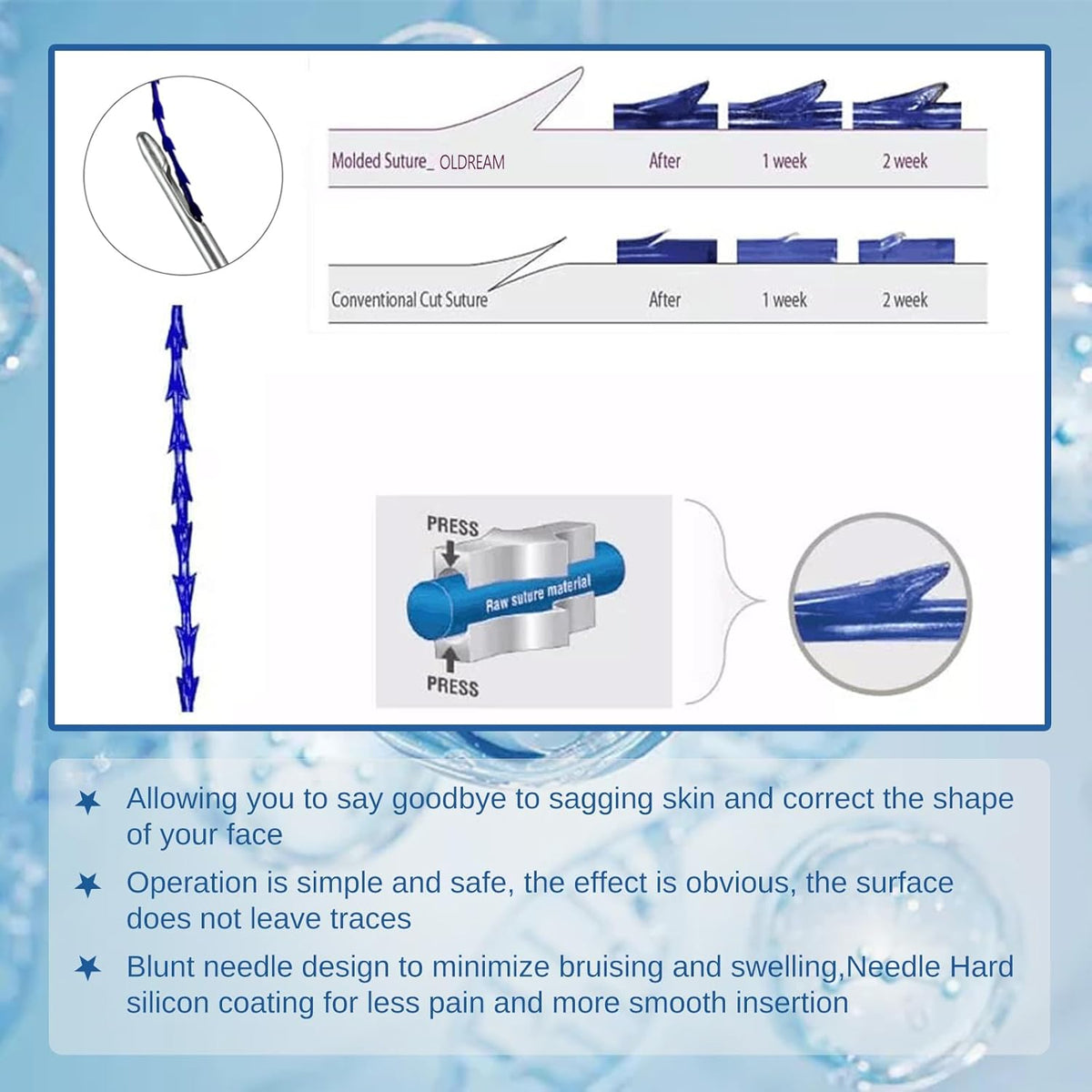 fishbone molding cog pdo threads