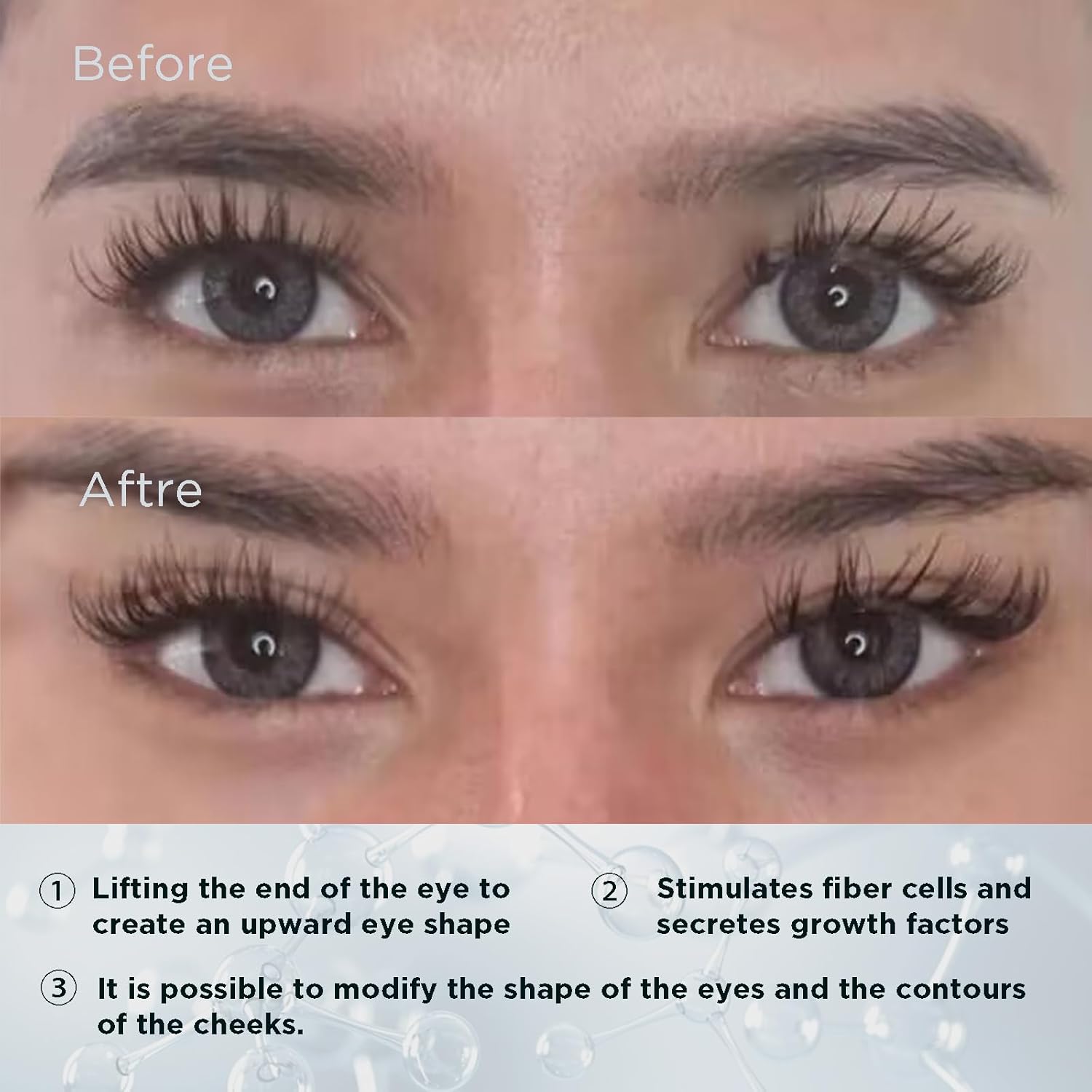 cat eye, eyebrow lifting pdo threads