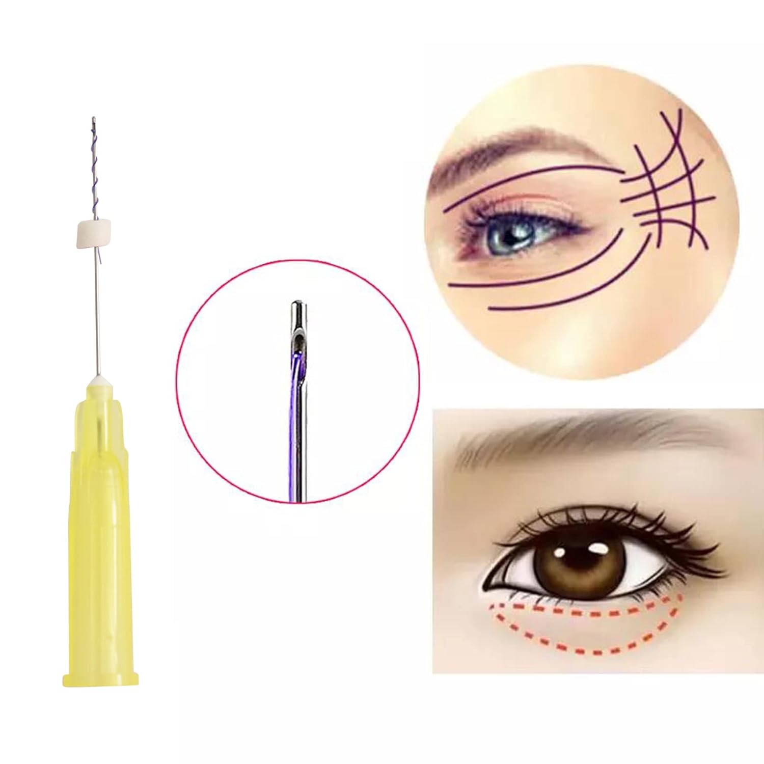 pdo eye threads