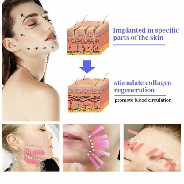 non-invasive aesthetics near me pdo threads